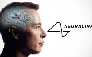 Read more about the article Neuralink’s First Patient: A Game-Changing Experience