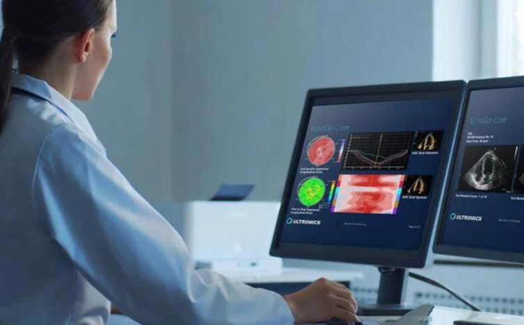 You are currently viewing AI Enhances Cath Lab to Predict Heart Health