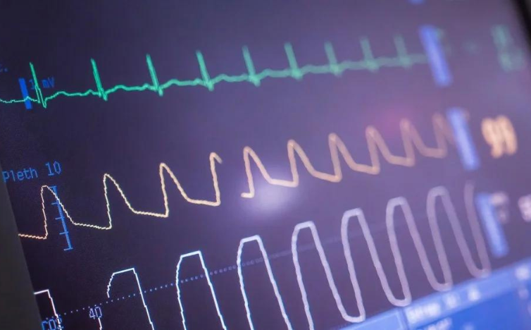 You are currently viewing AI Uses Fewer ECG Leads to Diagnose Heart Conditions