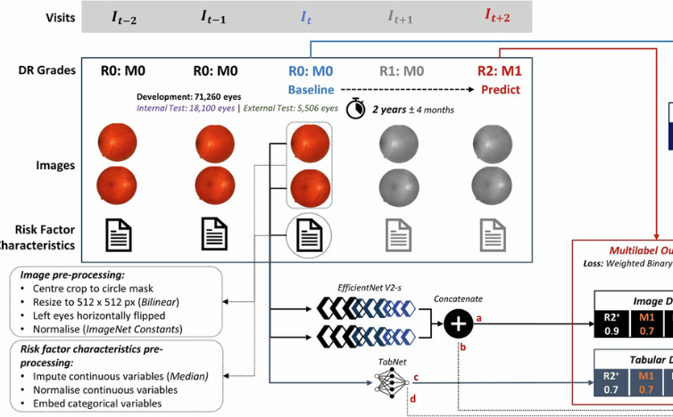 Read more about the article AI Tool Improves Diabetic Eye Screening Using Eye Images