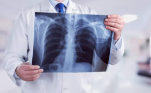 Read more about the article AI to Help Doctors Find Broken Bones on X-rays Faster