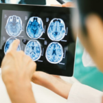 Meet Sturgeon: AI That Helps Doctors Find Brain Tumor Faster