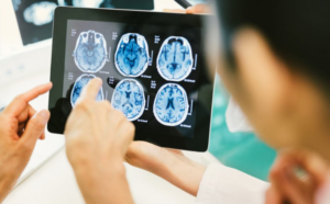 Read more about the article Meet Sturgeon: AI That Helps Doctors Find Brain Tumor Faster