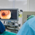 AI Tool Improves Polyp Detection During Colonoscopy