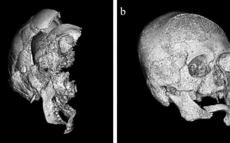 Read more about the article AI Tool Helps Forensic Experts Identify Skulls Faster