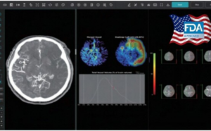 Read more about the article Japan Approves JLK’s AI Tool for Faster Stroke Diagnosis