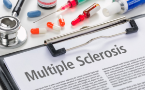Read more about the article AI Tool Tracks MS Treatment Progress with Brain Scans