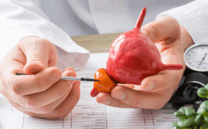 Read more about the article AI Helps Decide Hormone Therapy Length in Prostate Cancer