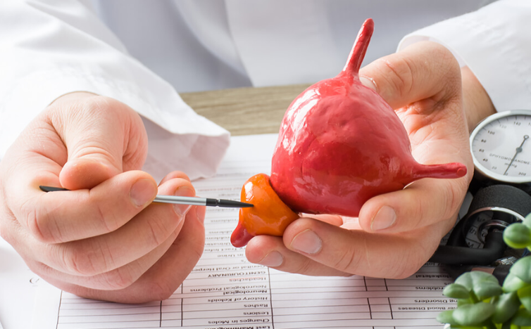 You are currently viewing AI Helps Decide Hormone Therapy Length in Prostate Cancer