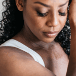 AI Tool Checks Eczema Severity Using Smartphone Photos