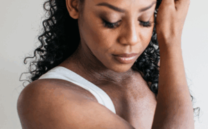 Read more about the article AI Tool Checks Eczema Severity Using Smartphone Photos