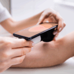 AI Tool for Checking Skin Cancer Gets NHS Approval