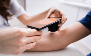 Read more about the article AI Tool for Checking Skin Cancer Gets NHS Approval